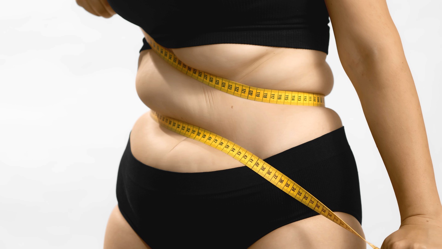 Bypass Gastrique vs Sleeve Gastrectomie : Un Guide Comparatif